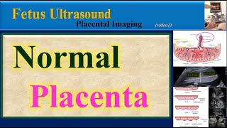 Placenta  Anatomy  Surface  Structure  Hindi [upl. by Utta]