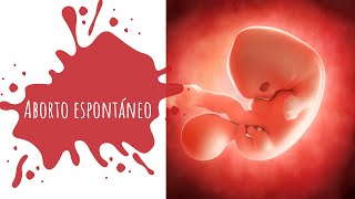 ABORTO ESPONTÁNEO CAUSAS SÍNTOMAS tipos de aborto y TRATAMIENTO [upl. by Eek918]