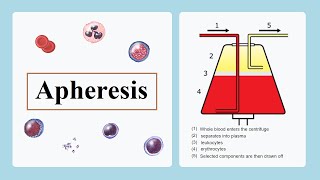 apheresis [upl. by Releehw]