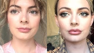 05ML LIP FILLERS  BEFORE AND AFTER  ONE WEEK VLOG 💉 [upl. by Ottie955]