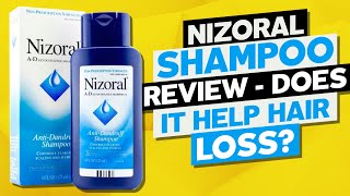 Nizoral Shampoo Review  Does it Help Hair Loss [upl. by Sherlock]