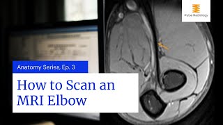 How to Scan an MRI Elbow [upl. by Vladamar369]