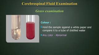 Cerebrospinal Fluid Examination CSF [upl. by Sucramad]