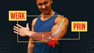 How To Fix Elbow Pain BULLETPROOF YOUR ELBOWS [upl. by Nossah]