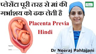 गर्भावस्था के अल्ट्रासाउंड से खुद जाने लड़का होगा या लड़की Gender Prediction by Ramzi Theory in Hindi [upl. by Ree946]