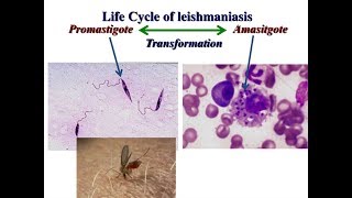 LEISHMANIASIS  Parasitología Botero y ´´Becerril´´ Resumen [upl. by Claresta]