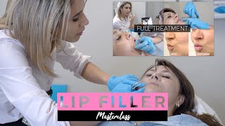 Natural Looking and Beautiful Lips  Dermal Filler Training Masterclass [upl. by Yrrehc]