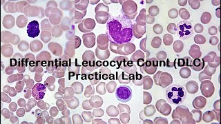 Differential Leucocyte Count DLC Practical Lab [upl. by Rosol304]