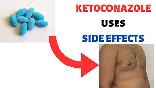 KETOCONAZOLE NIZORAL Uses Side effects Review Shampoo Cream Soap Lotion [upl. by Triplett769]