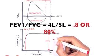 Understanding Spirometry  Normal Obstructive vs Restrictive [upl. by Ronny]