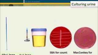 Urine Culture How To Interpret Count [upl. by Elleinet]