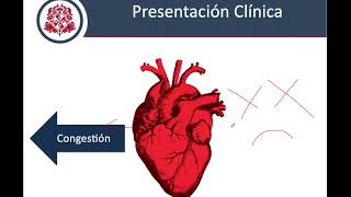 Insuficiencia Cardiaca  Fisiopatología Clínica y Diagnostico [upl. by Judith]