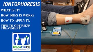 Iontophoresis for Inflammation with OrthoEvalPal [upl. by Monroe226]