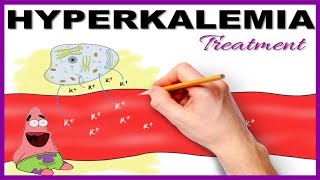 Hyperkalemia with ECG changes Treatment  Mnemonic Series 15 [upl. by Ivad]