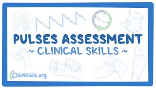 Clinical Skills Pulses assessment [upl. by Mena]