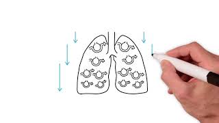 Everything you need to know about the ventilation perfusion ratio [upl. by Demakis40]