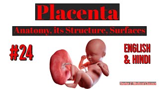 Circumvallate Placenta with Placental Shelf [upl. by Yazbak]