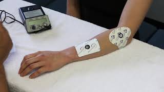 How to set up Iontophoresis [upl. by Floridia138]