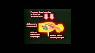 Positional Asphyxia [upl. by Teyut]